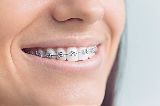 Emergency Dental Services in Harbison Canyon, CA